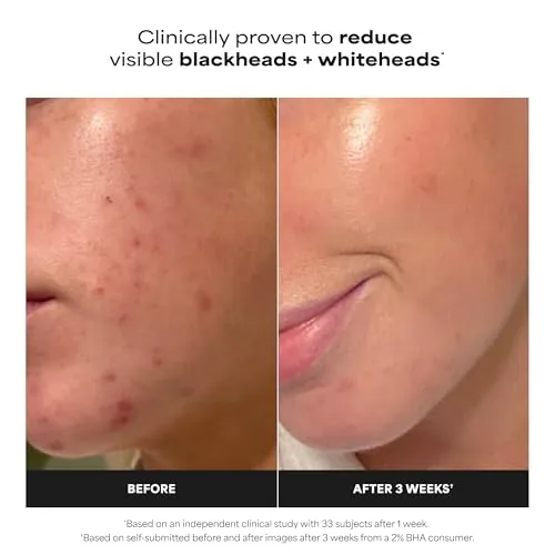 Paula's Choice 2% BHA Liquid Exfoliant Review image 3