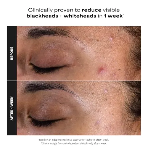 Paula's Choice 2% BHA Liquid Exfoliant Review image 5